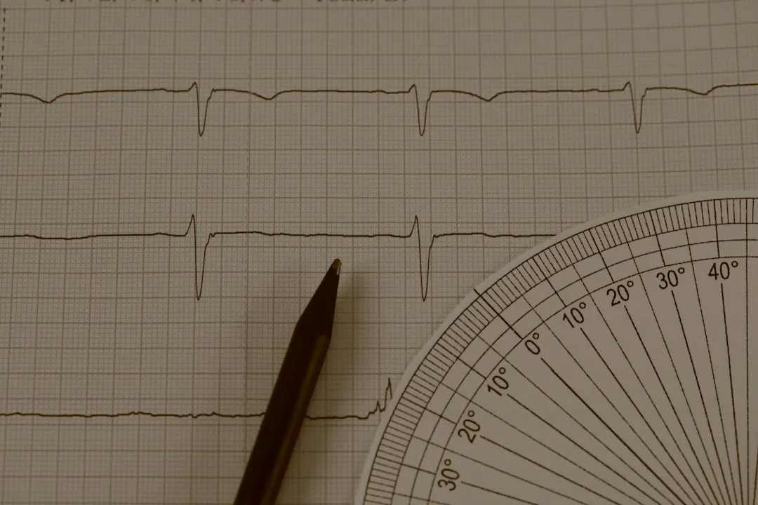 Electrocardiogram tracing with pencil and protractor